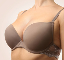 Breast_augmentation_after