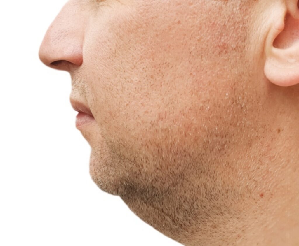neck1