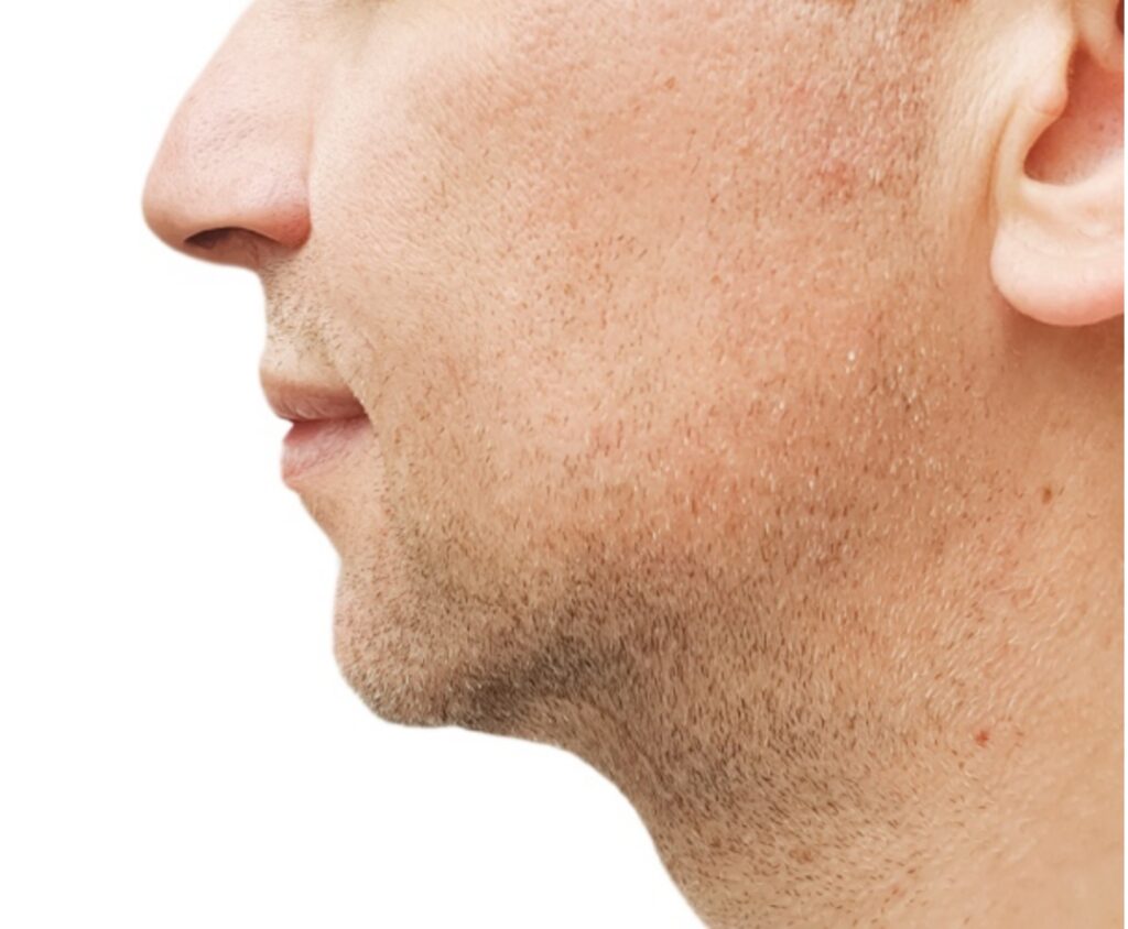 neck2