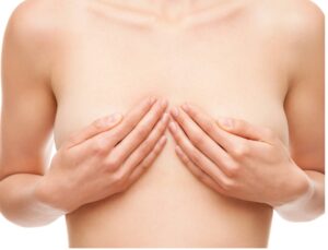 breast augmentation before image. Plastic surgery in Dubai