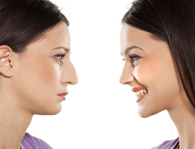 Scar Less Rhinoplasty Technique in UAE by Dr Alexandre Dion