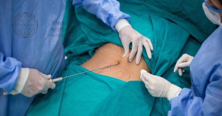 Is Liposuction A Safe Procedure