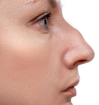 SLR (Scar Less Rhinoplasty)