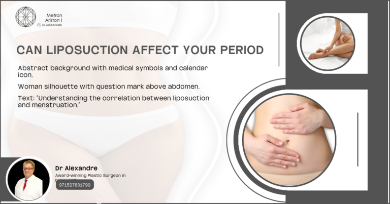 Can Liposuction Affect Your Period