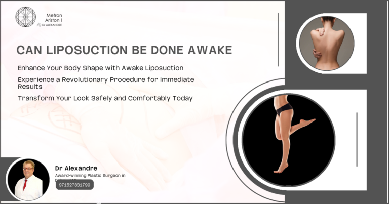 Can Liposuction Be Done Awake