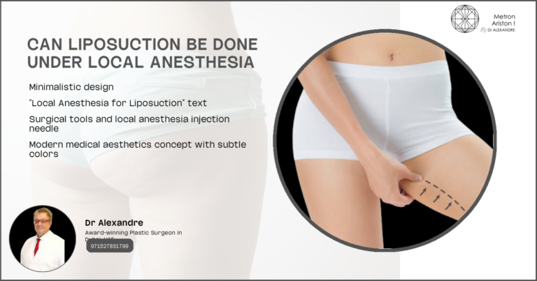 Can Liposuction Be Done Under Local Anesthesia