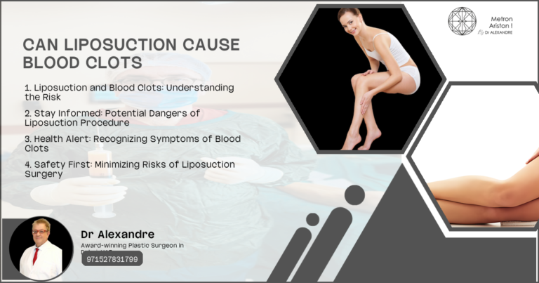 Can Liposuction Cause Blood Clots