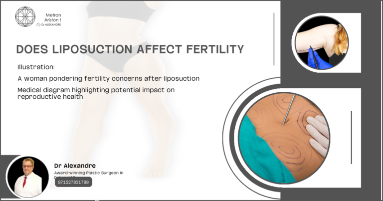 Does Liposuction Affect Fertility