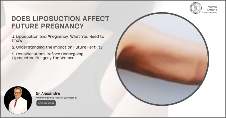 Does Liposuction Affect Future Pregnancy