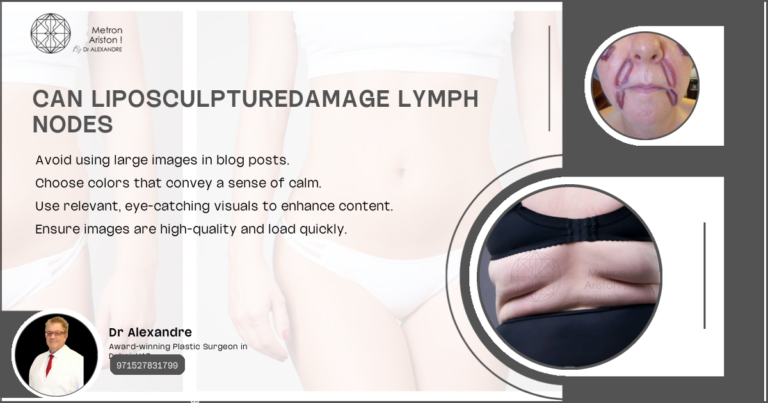 Can Liposculpturedamage Lymph Nodes