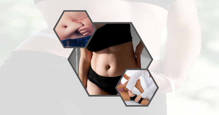 Can Liposuction Get Rid Of Gynecomastia