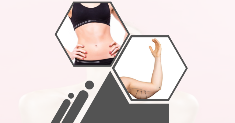 Can Liposuction Help Fatty Liver