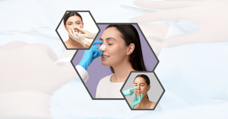 Rhinoplasty Meaning: What It Is And How It Works