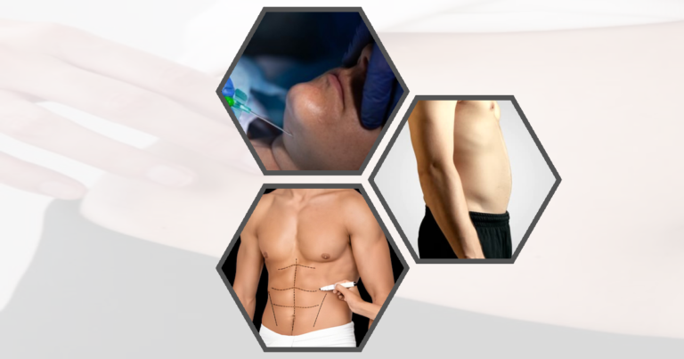 Can Liposuction Remove All Fat