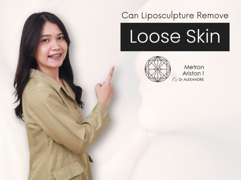 Can Liposculpture Remove Loose Skin