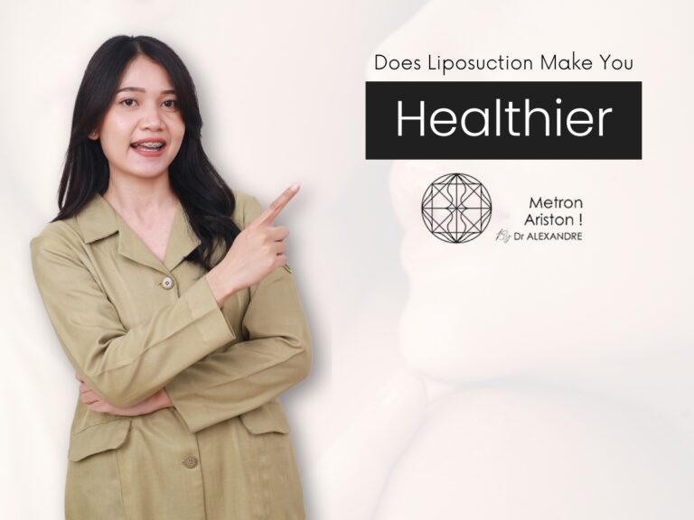 Does Liposuction Make You Healthier